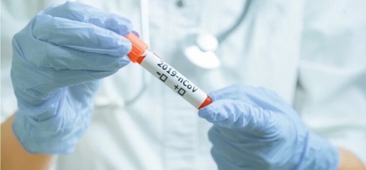 <strong>Πότε κύριε Γεωργιάδη θα τηρήσετε επιτέλους τη δέσμευσή σας για την επαναπρόσληψη των εργαζομένων με τρίμηνες συμβάσεις COVID-19;</strong>